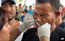 Un migrante tiene sus labios cosidos juntos como una forma de protesta para el paso legal en Huixtla, estado de Chiapas, México, jueves 2 de noviembre de 2023. (AP Photo/Edgar Hernández Clemente)e)